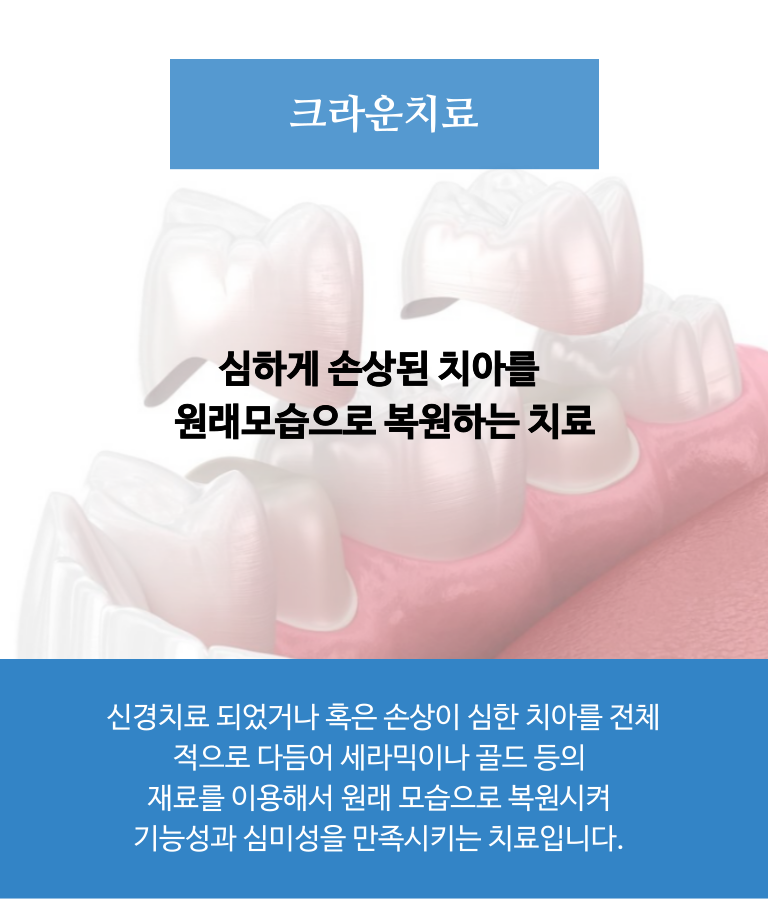 크라운 치료