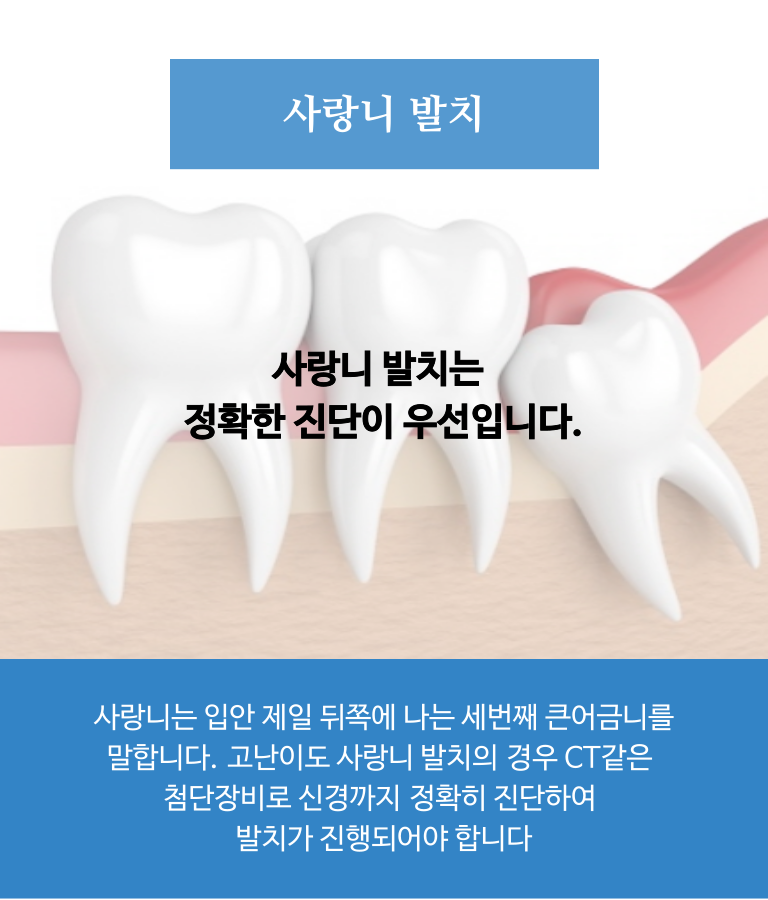 사랑니 발치